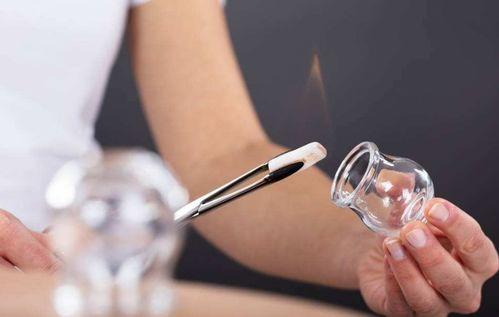 腰疼拔罐视频,跟随视频学习拔罐技巧